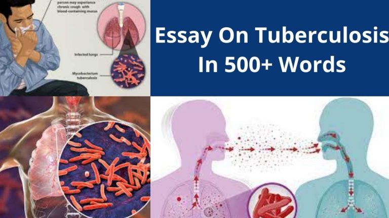 Essay On Tuberculosis